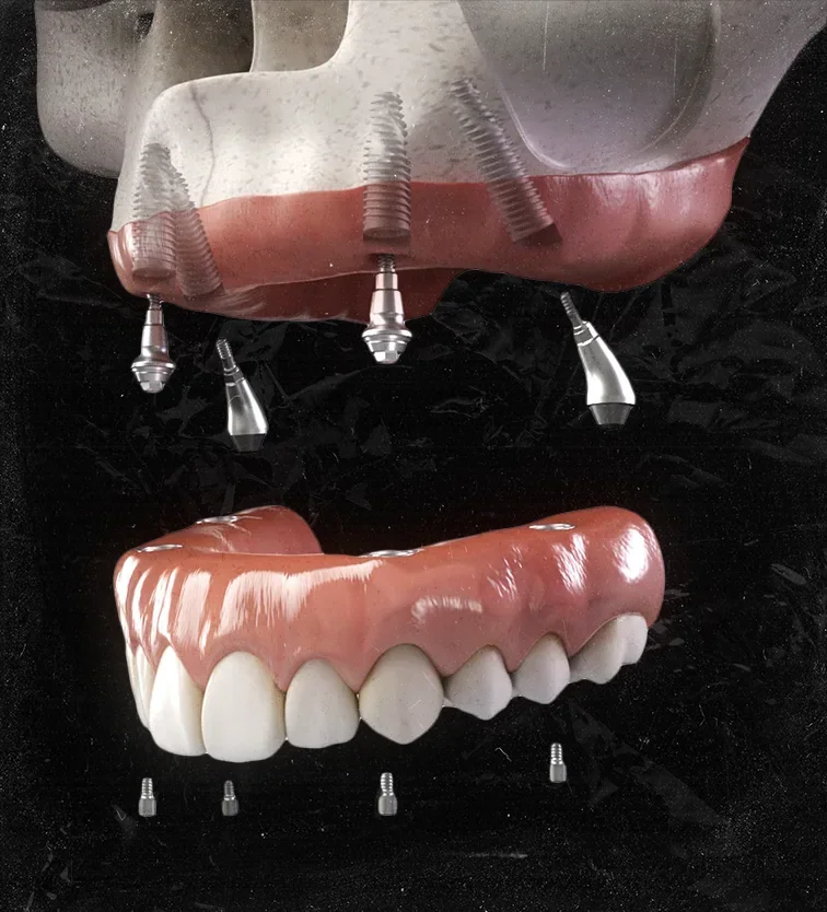 Dental Tourism Marketing in Turkey: What International Patients Are Not Told